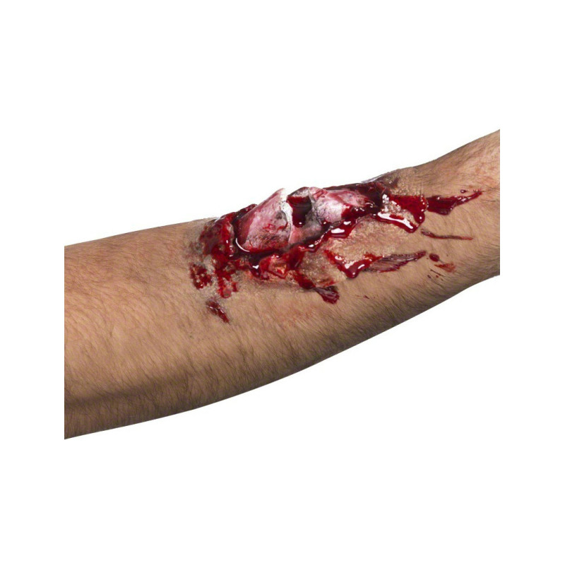 Fausse blessure os cass√©  