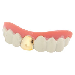 Destockage Dentier Dent en Or Rigide